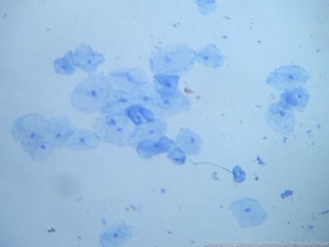 Epithelial cells stained with methylene blue. The cells are approx. 60 μm across.